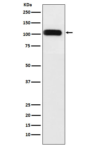 Western blot analysis of SERCA1 ATPase expression in Human fetal muscle lysate