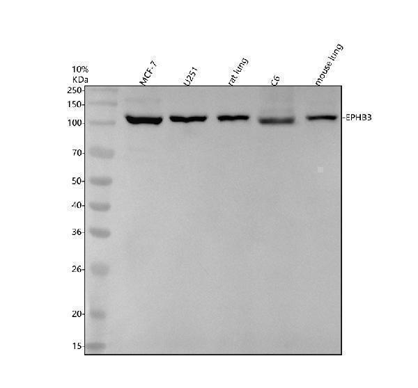 Western blot analysis of EPHB3 using anti-EPHB3 antibody (M04659-1)