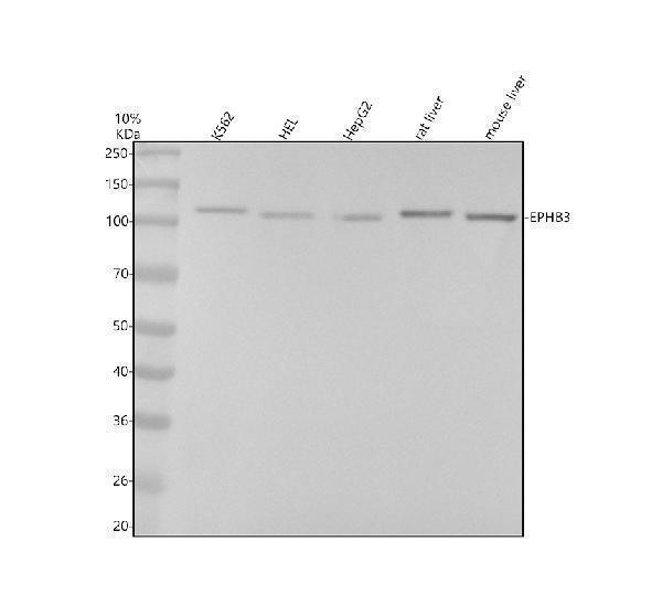 Western blot analysis of EPHB3 using anti-EPHB3 antibody (M04659-1)