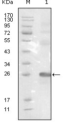 Western Blot analysis using EphB3 Monoclonal Antibody against truncated EphB3-His recombinant protein