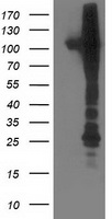 HEK293T cells were transfected with the pCMV6-ENTRY control (Left lane) or pCMV6-ENTRY NEK9 (Right lane) cDNA for 48 hrs and lysed