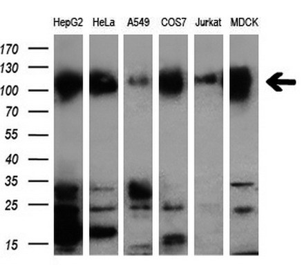 Western blot analysis of extracts (10ug) from 6 different cell lines by using anti-NEK9 monoclonal antibody (1:200)