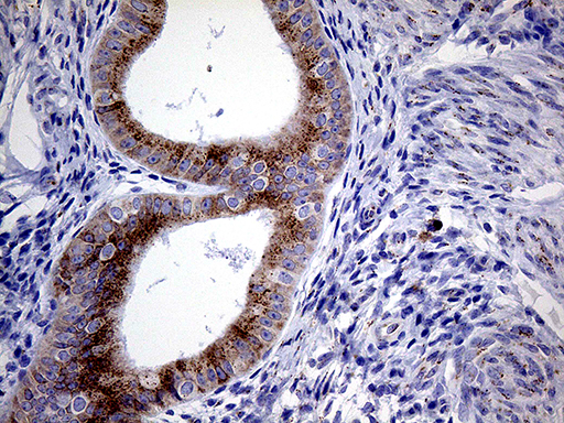 m04663 anti myotilin myot mouse monoclonal antibody clone id oti5e11 ihc testing 4