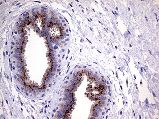 m04663 anti myotilin myot mouse monoclonal antibody clone id oti5e11 ihc testing 5