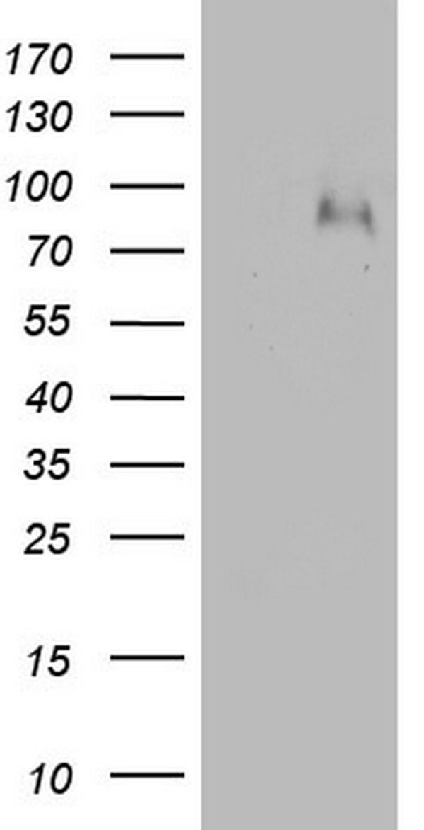 HEK293T cells were transfected with the pCMV6-ENTRY control (Left lane) or pCMV6-ENTRY F13B (Right lane) cDNA for 48 hrs and lysed