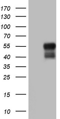 HEK293T cells were transfected with the pCMV6-ENTRY control (Left lane) or pCMV6-ENTRY BHLHE41 (Right lane) cDNA for 48 hrs and lysed