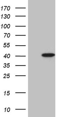 HEK293T cells were transfected with the pCMV6-ENTRY control (Left lane) or pCMV6-ENTRY RNF41 (Right lane) cDNA for 48 hrs and lysed