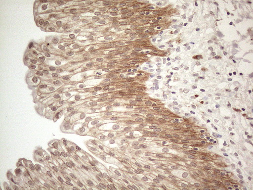 Immunohistochemical staining of paraffin-embedded Human bladder tissue within the normal limits using anti-MARK4 mouse monoclonal antibody
