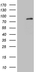 HEK293T cells were transfected with the pCMV6-ENTRY control (Left lane) or pCMV6-ENTRY MARK4 (Right lane) cDNA for 48 hrs and lysed