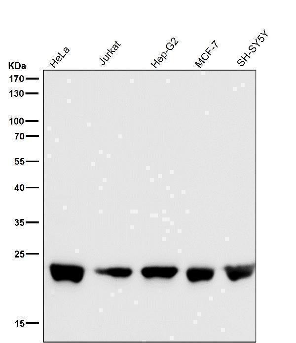 All lanes use the Antibody at 1:5K dilution for 1 hour at room temperature