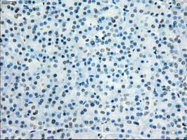m04689 1 anti kdm4c mouse monoclonal antibody clone id oti4b1 ihc testing 1