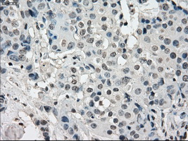 m04689 anti kdm4c mouse monoclonal antibody clone id oti5b9 ihc testing 10