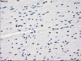 m04689 anti kdm4c mouse monoclonal antibody clone id oti5b9 ihc testing 11