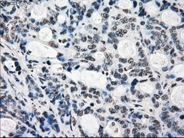 m04689 anti kdm4c mouse monoclonal antibody clone id oti5b9 ihc testing 12