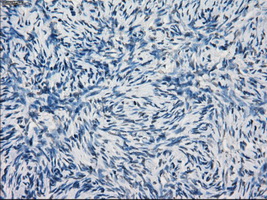 m04689 anti kdm4c mouse monoclonal antibody clone id oti5b9 ihc testing 3
