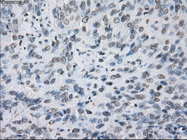 m04689 anti kdm4c mouse monoclonal antibody clone id oti5b9 ihc testing 4