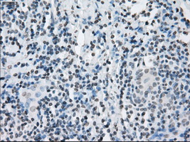 m04689 anti kdm4c mouse monoclonal antibody clone id oti5b9 ihc testing 6