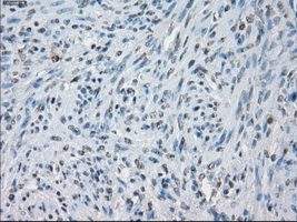 m04689 anti kdm4c mouse monoclonal antibody clone id oti5b9 ihc testing 7
