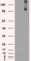m04689 anti kdm4c mouse monoclonal antibody clone id oti5b9 wb testing 1
