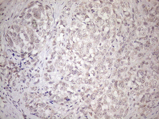 m04692 anti hsf2 mouse monoclonal antibody clone id oti3e1 ihc testing 4