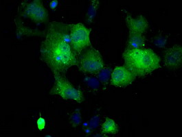 m04694 anti gbe1 mouse monoclonal antibody clone id oti1d11 if testing 10