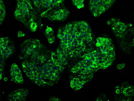 m04694 anti gbe1 mouse monoclonal antibody clone id oti1d11 if testing 11