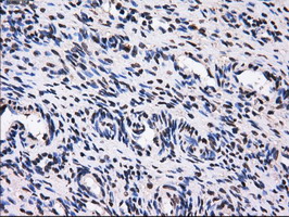 m04694 anti gbe1 mouse monoclonal antibody clone id oti1d11 ihc testing 5