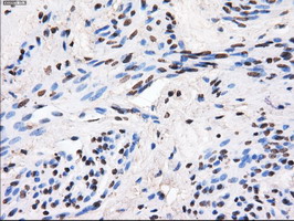 m04694 anti gbe1 mouse monoclonal antibody clone id oti1d11 ihc testing 6