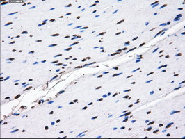 m04694 anti gbe1 mouse monoclonal antibody clone id oti1d11 ihc testing 7