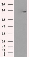 HEK293T cells were transfected with the pCMV6-ENTRY control (Left lane) or pCMV6-ENTRY GBE1 (Right lane) cDNA for 48 hrs and lysed