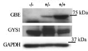 Figure from citation: Western Blot of GBE protein level by using anti-GBE antibody in mouse muscle extracts obtained from Gbe1-/-