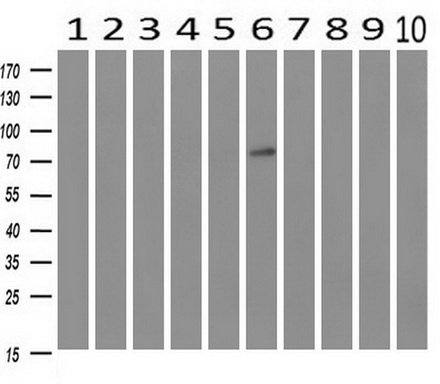 Western blot analysis of extracts (10ug) from 10 Human tissue by using anti-GBE1 monoclonal antibody at 1:500 (1: Testis; 2: Omentum; 3: Uterus; 4: Breast; 5: Brain; 6: Liver; 7: Ovary; 8: Thyroid gland; 9: colon;10: spleen)