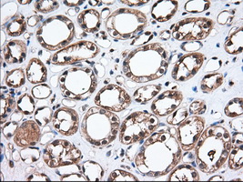 m04697 anti tbxas1 mouse monoclonal antibody clone id oti2c1 ihc testing 4