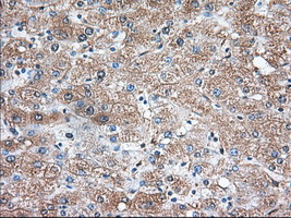 m04697 anti tbxas1 mouse monoclonal antibody clone id oti2c1 ihc testing 5