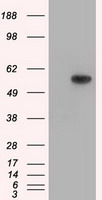HEK293T cells were transfected with the pCMV6-ENTRY control (Left lane) or pCMV6-ENTRY TBXAS1 (Right lane) cDNA for 48 hrs and lysed