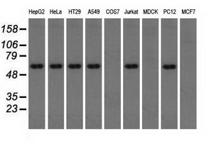 Western blot analysis of extracts (35ug) from 9 different cell lines by using anti-TBXAS1 monoclonal antibody