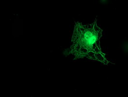 m04701 1 anti tropomodulin 1 tmod1 mouse monoclonal antibody clone id oti2c2 if testing 5