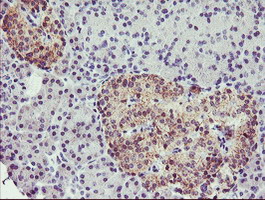 m04701 1 anti tropomodulin 1 tmod1 mouse monoclonal antibody clone id oti2c2 ihc testing 3