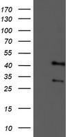 m04701 1 anti tropomodulin 1 tmod1 mouse monoclonal antibody clone id oti2c2 wb testing 1