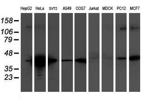 m04701 1 anti tropomodulin 1 tmod1 mouse monoclonal antibody clone id oti2c2 wb testing 2