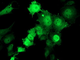 m04701 anti tropomodulin 1 tmod1 mouse monoclonal antibody clone id oti1f2 if testing 5