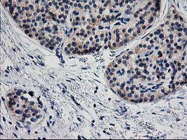 m04701 anti tropomodulin 1 tmod1 mouse monoclonal antibody clone id oti1f2 ihc testing 3