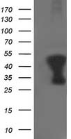 m04701 anti tropomodulin 1 tmod1 mouse monoclonal antibody clone id oti1f2 wb testing 1