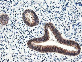m04706 anti prmt2 mouse monoclonal antibody clone id oti3a3 ihc testing 4