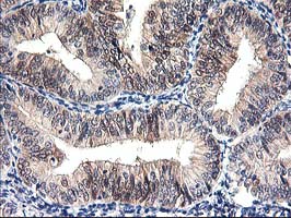 m04706 anti prmt2 mouse monoclonal antibody clone id oti3a3 ihc testing 5