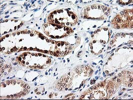 m04706 anti prmt2 mouse monoclonal antibody clone id oti3a3 ihc testing 7