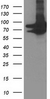 HEK293T cells were transfected with the pCMV6-ENTRY control (Left lane) or pCMV6-ENTRY PRMT2 (Right lane) cDNA for 48 hrs and lysed