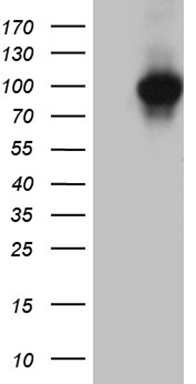 HEK293T cells were transfected with the pCMV6-ENTRY control (Left lane) or pCMV6-ENTRY KEL (Right lane) cDNA for 48 hrs and lysed