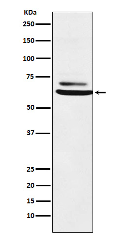Western blot analysis of ENT2 expression in K562 cell lysate. Western blot analysis of ENT2 expression in K562 cell lysate.