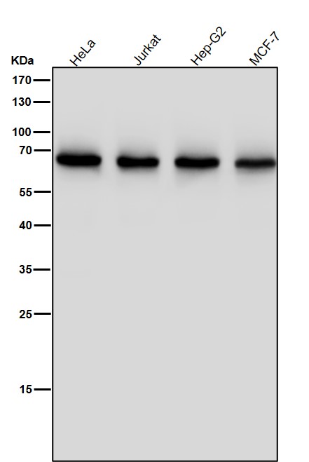 All lanes use the Antibody at 1:5K dilution for 1 hour at room temperature.